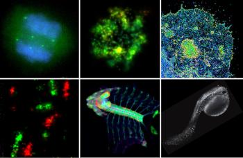 six examples of colorful microscopy.